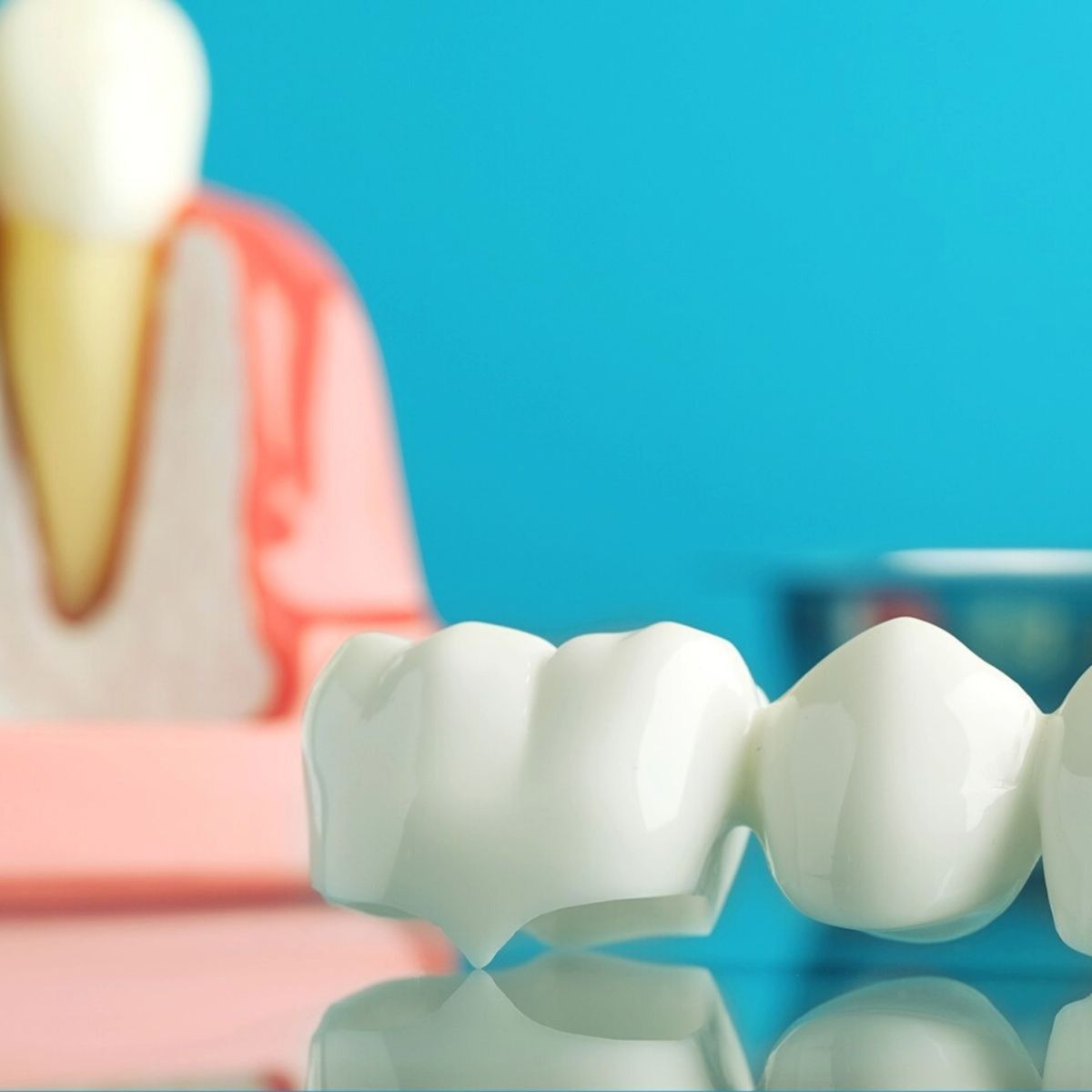 Prothèse dentaire en céramique posée sur une surface réfléchissante avec un modèle dentaire en arrière-plan